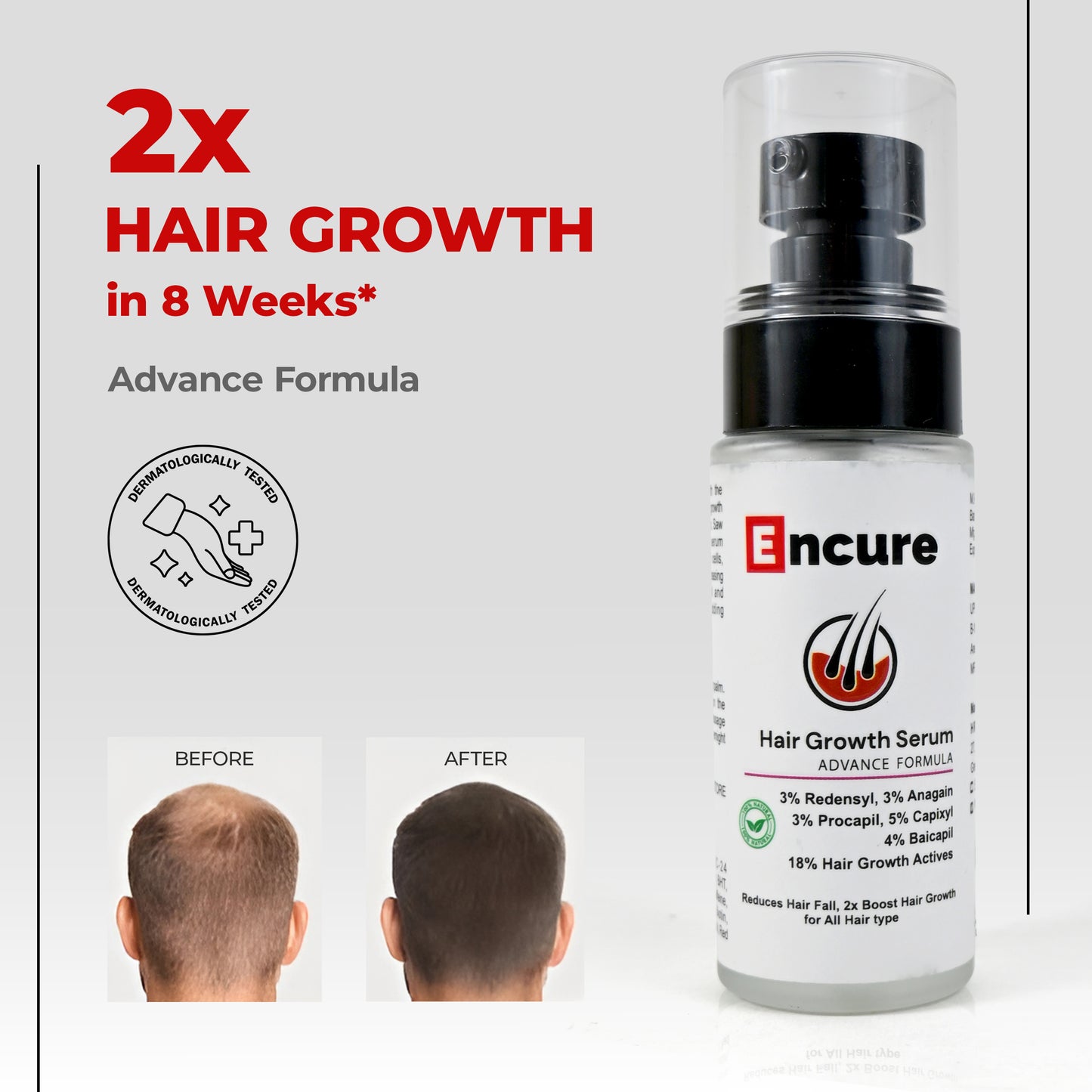 ENCURE™ Hair Growth Serum | Advanced Formula with 3 % Redensyl, 3 % Anagain, 3 % Procapil, 5 % Capixyl & 4% Baicapil | 18% Hair Growth Actives | Thicker & Stronger Hair Growth | Stimulates Hair Growth & Hair Fall Control Serum for Men & Women, 50ml